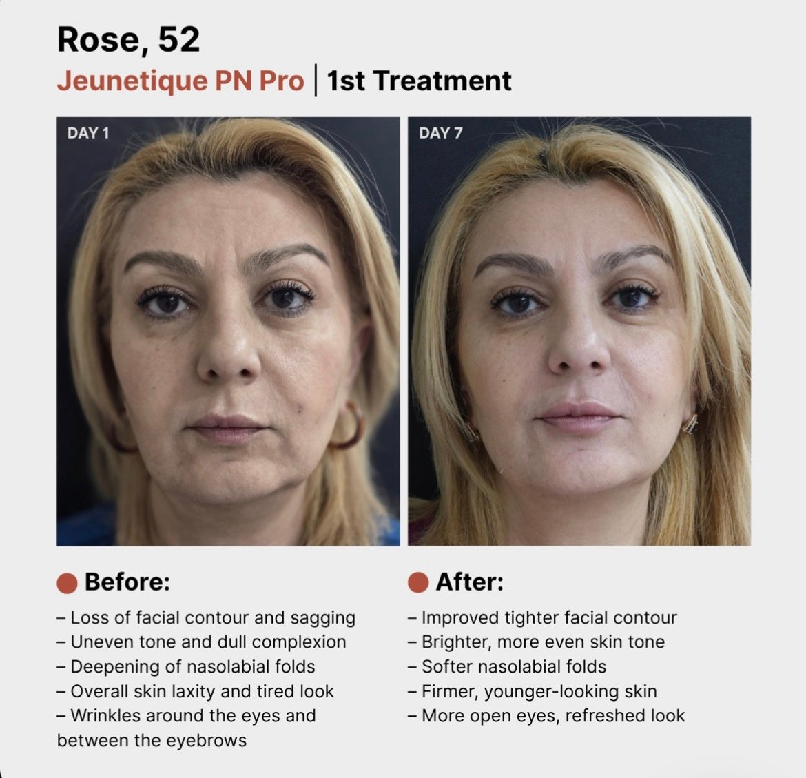 Jeunetique PN PRO 2.5ml - Image 2
